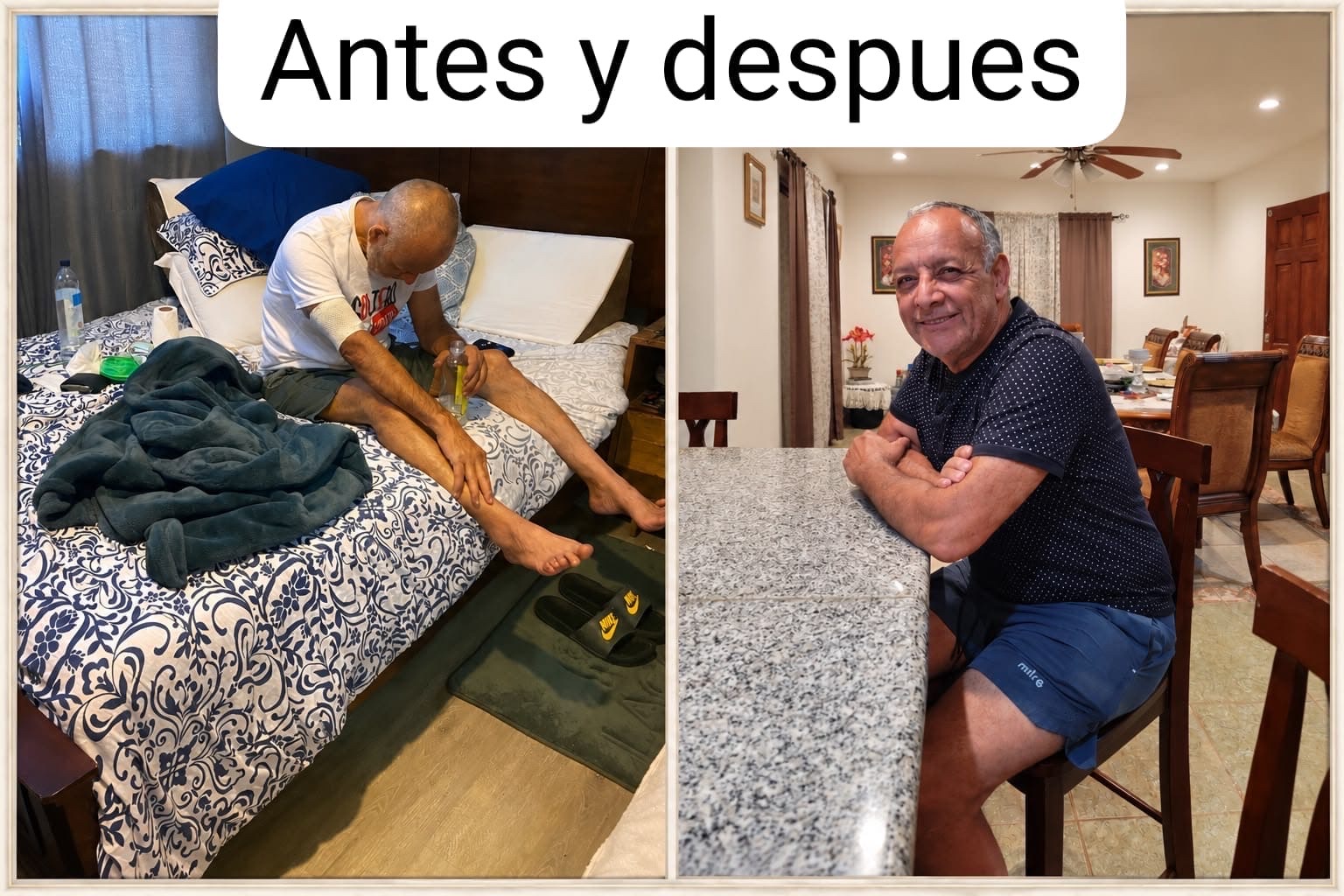 Fotos de antes y después de un hombre tras la limpia con agua de hierbas
